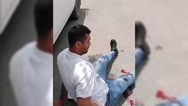 Kendisini rahatsız eden kişiyi bacağından yaralayıp sosyal medyada paylaştı; tutuklandı